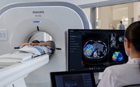Philips Verida Brings AI-Powered Spectral CT to Cancer Imaging